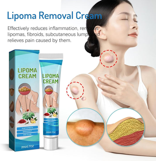 Crema para reducir bultos de grasa (lipomas)